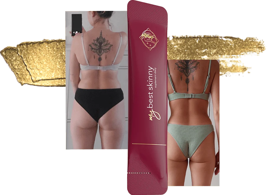 MyBestSkinny